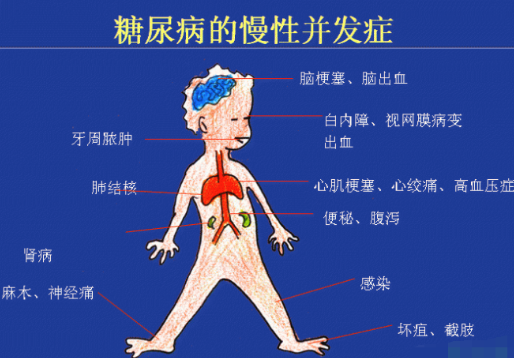 你還在害怕高血糖嗎？科學補硒不“恐糖”