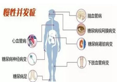 遠(yuǎn)離高血糖并發(fā)癥，請記住一點(diǎn)，學(xué)會“補(bǔ)硒”