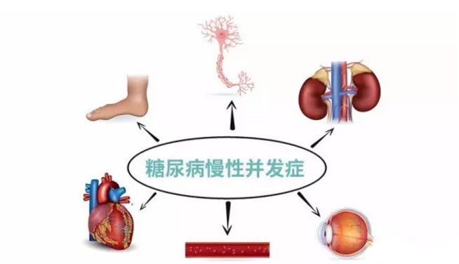 血糖波動大,并發(fā)癥來得快,糖友要多補硒